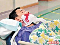 為保 iPhone　學生遭劏面