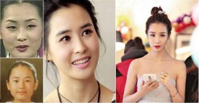 李多海整容3步曲,逐格睇!