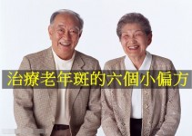 治療老年斑的六個小偏方