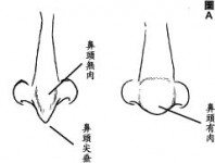 提防損友面相觀