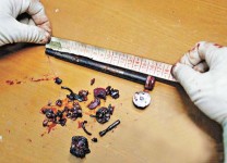 鋼條插肛門,少年失血過多不治